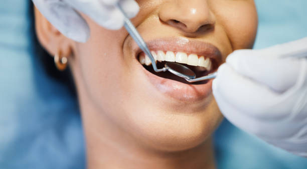 Best Same-Day Emergency Dentist in Mccoll, SC