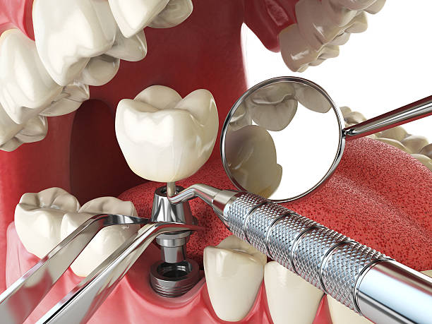 Best Emergency Broken Tooth Repair in Mccoll, SC